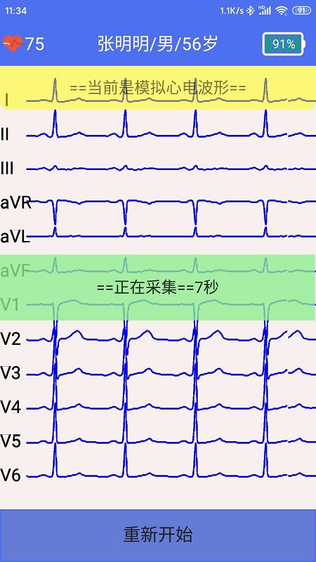 健康2030智能读图心电图系统V1.0截图2