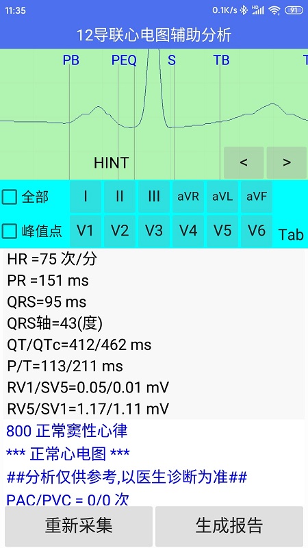 健康2030智能读图心电图系统V1.0截图4
